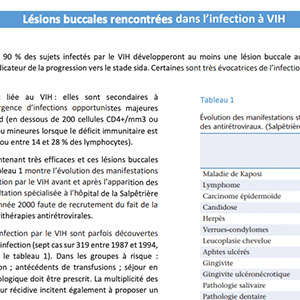 Lésions buccales rencontrées dans les infections à VIH et VHC